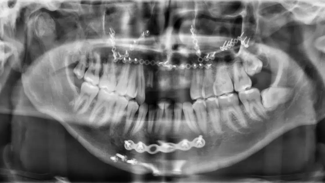 Facial Trauma Procedure Image