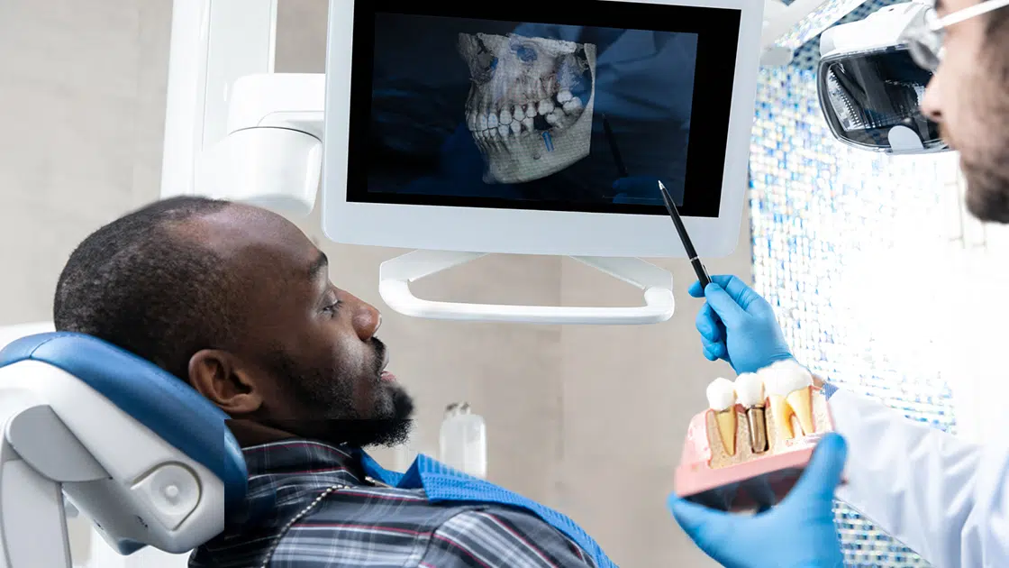 Dental Implants Service Photo
